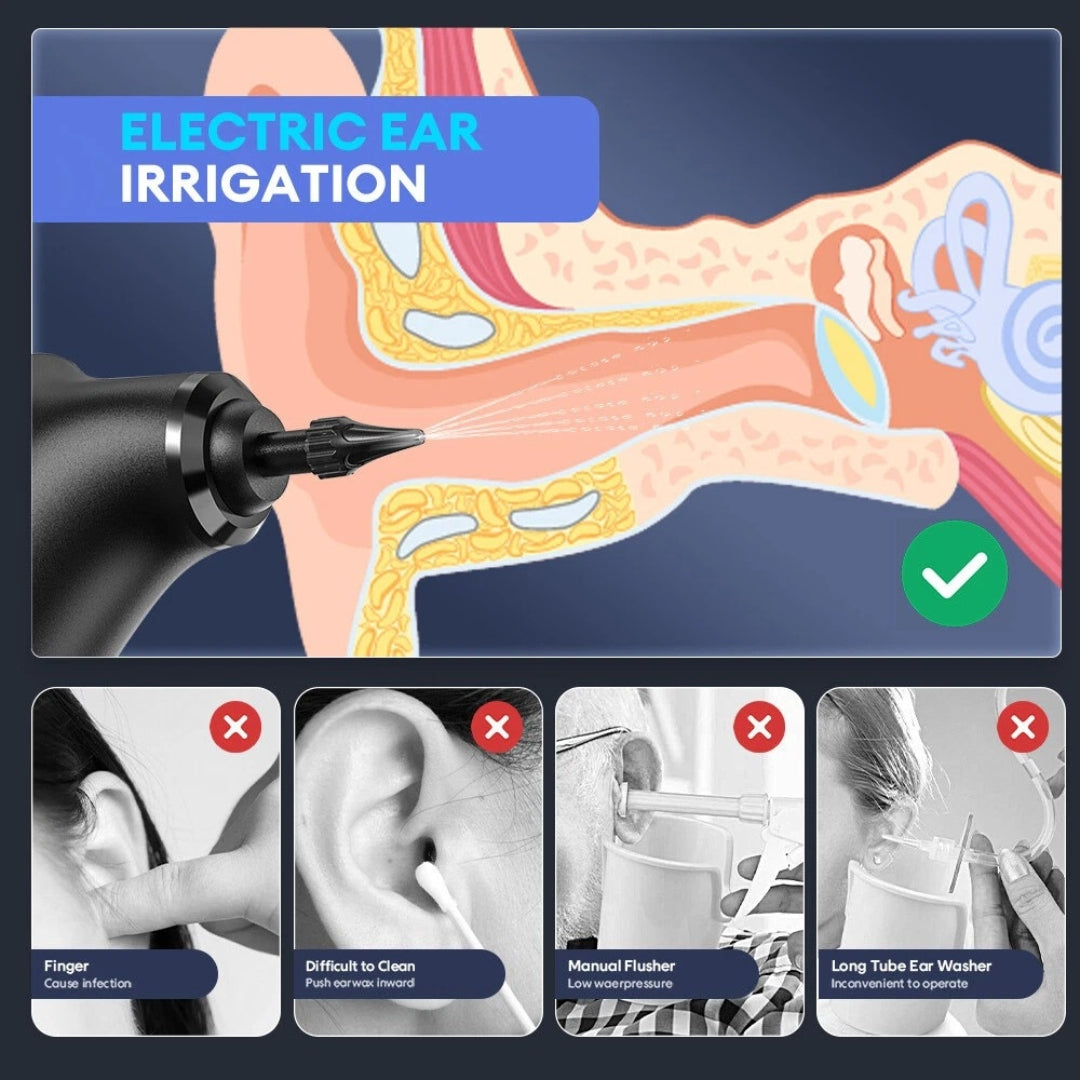 EarJoy™ - Ear Wax Remover