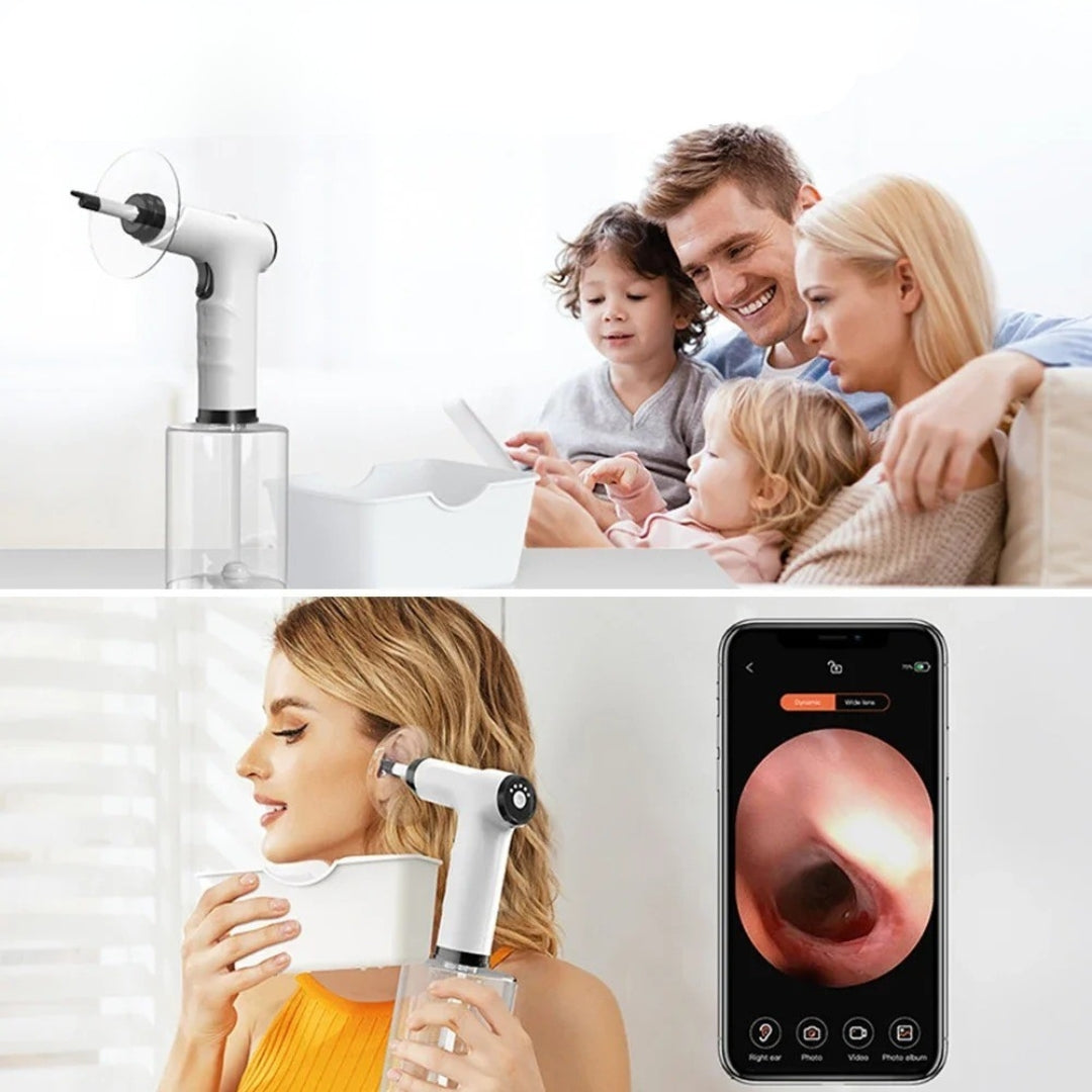 SonicRinse™ - Ear Cleaning kit