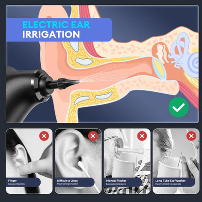 EarJoy™ - Ear Wax Remover